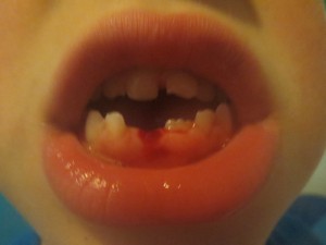 IMG_0377